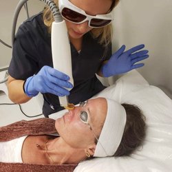 MedSpaPGH - Spider veins removal procedure. Quick and painless.