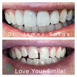 Oak Hollow Family Dentistry - Cosmetic Smile Makeovers