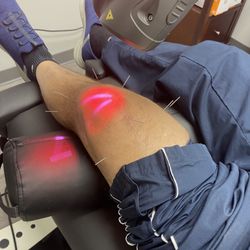 Hogan Spine & Rehabilitation Center - Acupuncture and laser
