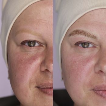 SkinFlex Studio - Before/After - Permanent Makeup Near Me - Beverly Hills, California SkinFlex Studio - Before/After - Permanent Makeup Near Me - Beverly Hills, California