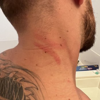Green Leaf Spa - That massage therapist scatched my partners neck on both side. - Massage Therapy Near Me - Concord, California Green Leaf Spa - That massage therapist scatched my partners neck on both side. - Massage Therapy Near Me - Concord, California