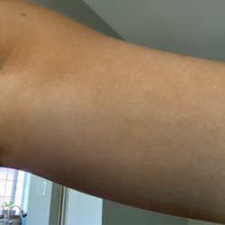 Glow Body & Sun - Fading on bicep (after two days)