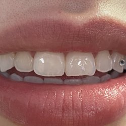 VIP Whitening & Tooth Gems by Brandi
