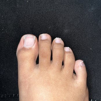Noire Nail and Lash Bar - Damaged toe nails - Nail Salons Near Me - Orlando, Florida Noire Nail and Lash Bar - Damaged toe nails - Nail Salons Near Me - Orlando, Florida