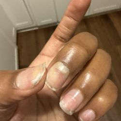 Exquisite Nails & Spa - Natural nail about to fall off
