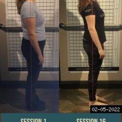 Symmetry - My before and after photos!