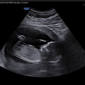 Forever Yours Ultrasound - Prenatal/Perinatal Care Near Me - Irvine, California Forever Yours Ultrasound - Prenatal/Perinatal Care Near Me - Irvine, California