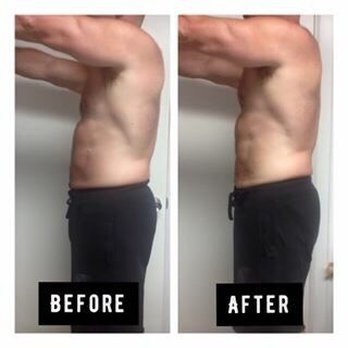 Tan N' Toned - After one 1hour sculpting treatment - Weight Loss Centers Near Me - League City, Texas Tan N' Toned - After one 1hour sculpting treatment - Weight Loss Centers Near Me - League City, Texas
