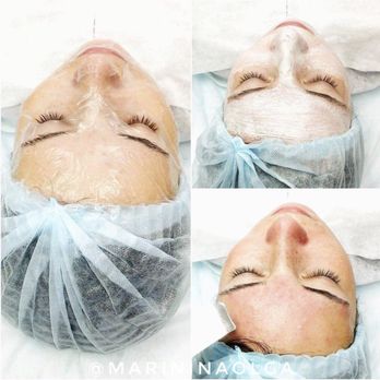 OlMar Esthetics - Skin Care Near Me - San Diego, California OlMar Esthetics - Skin Care Near Me - San Diego, California