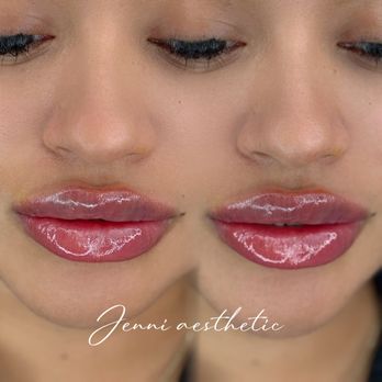 Eyecandy Lash Beauty - Lips enhancement - Eyelash Service Near Me - Katy, Texas Eyecandy Lash Beauty - Lips enhancement - Eyelash Service Near Me - Katy, Texas