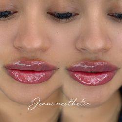 Eyecandy Lash Beauty - Lips enhancement
