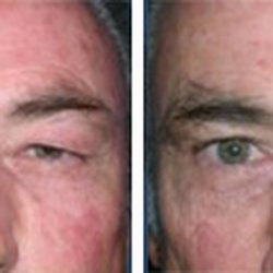 Fresno Plastic Surgery