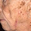 Nevada Center For Dermatology gift card
