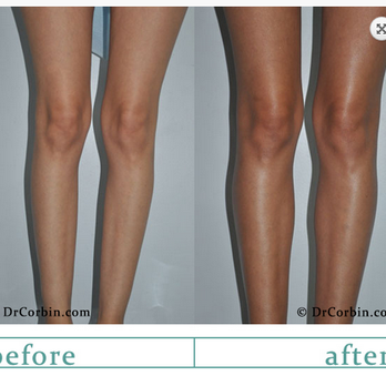 Frederic H Corbin, MD - Plastic Surgeons Near Me Frederic H Corbin, MD - Plastic Surgeons Near Me