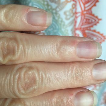 LUX SF - 3 cuts from file when they removed my gel. - Nail Salons Near Me - San Francisco, California LUX SF - 3 cuts from file when they removed my gel. - Nail Salons Near Me - San Francisco, California