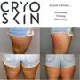 Photo of Flow Cryotherapy