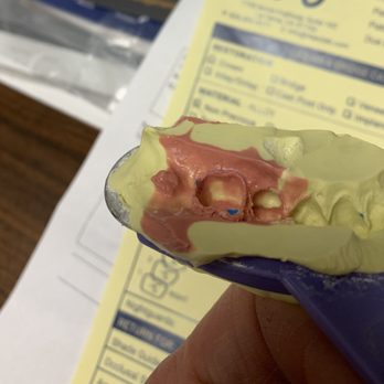 Diamond Dental Lab - Excellent impression provided - General Dentistry Near Me - San Dimas, California Diamond Dental Lab - Excellent impression provided - General Dentistry Near Me - San Dimas, California