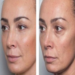Primary Aesthetic Skin Care