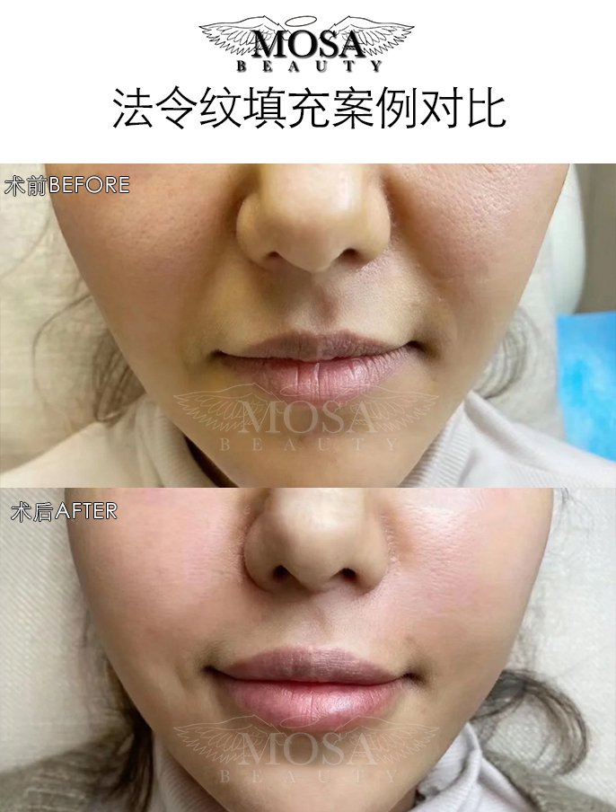 MOSA BEAUTY MEDICAL CENTER 196 Photos & 49 Reviews 301 W Valley