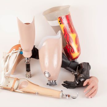 Winkley Orthotics & Prothetics - Winkley Prosthetic Sockets - Lower and Upper Limb - Orthotics Near Me - Coon Rapids, Minnesota Winkley Orthotics & Prothetics - Winkley Prosthetic Sockets - Lower and Upper Limb - Orthotics Near Me - Coon Rapids, Minnesota