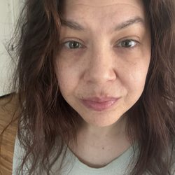 Ami Skin - After they ruined my face!!!!