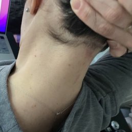 The red is a birthmark. I didn't take a picture after the cut. The red is a birthmark. I didn't take a picture after the cut.