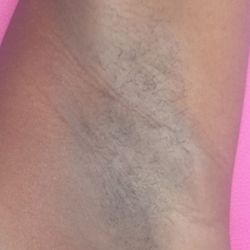 Xposure Home Waxing - Underarm Waxing