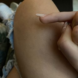 Lifted nail.