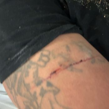 Rikers Island Correctional Facility - A lacerated arm - Police Departments Near Me - East Elmhurst, New York Rikers Island Correctional Facility - A lacerated arm - Police Departments Near Me - East Elmhurst, New York