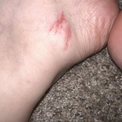 Couture Nails & Spa - Cuts from heel scrubber.