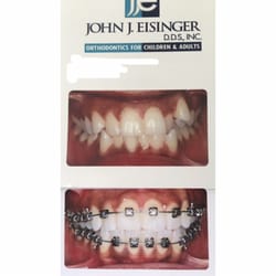 John J Eisinger, DDS - This is only 4 months after getting the Damon system. Thank you Dr.Eisenger and staff!!