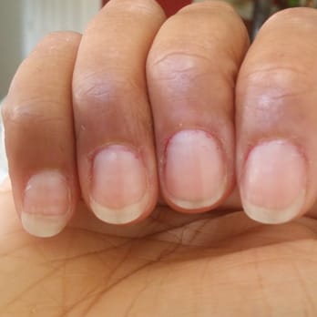 Nail Trix - After the "manicure". Paint job was so horrendous I made her take off the Polish and refund me. This is what I was left with. - Nail Salons Near Me - Bowie, Maryland Nail Trix - After the "manicure". Paint job was so horrendous I made her take off the Polish and refund me. This is what I was left with. - Nail Salons Near Me - Bowie, Maryland