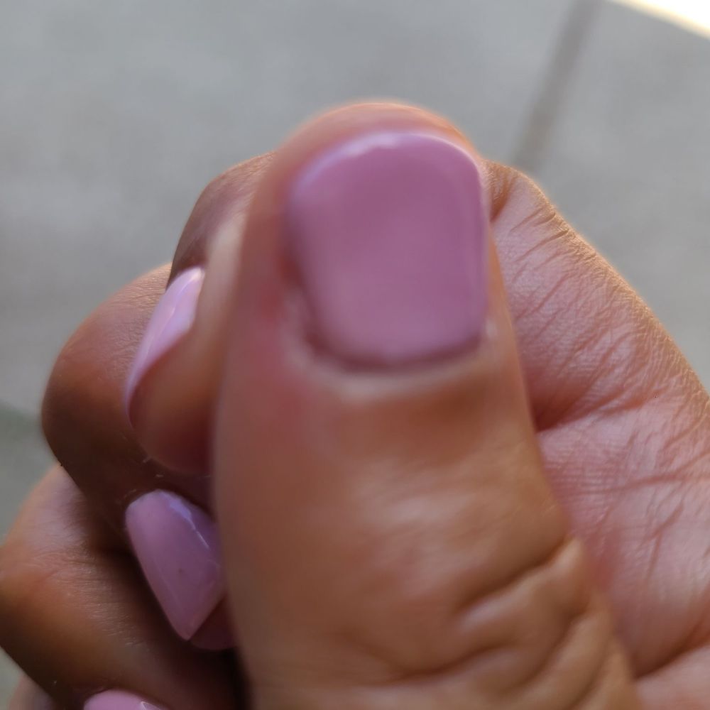 She clipped a whole layer of skin.