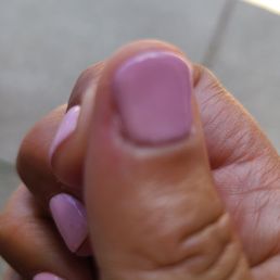 She clipped a whole layer of skin. She clipped a whole layer of skin.