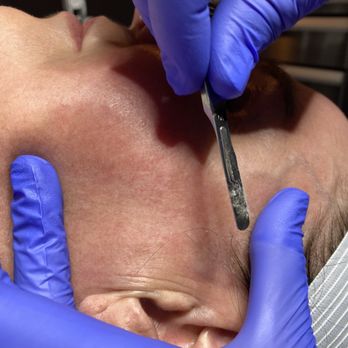 Renu Medispa - Medical Spas Near Me - Eagle, Idaho