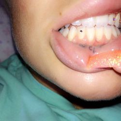 New small gem on bottom tooth