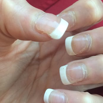 A Classy Nail & Spa - After a week and a half. Awful!! - Nail Salons Near Me - Corona, California