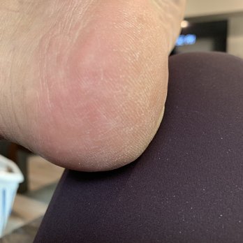SNS Exclusive Salon - Feel look dry and rough like nothing was even done  and I paid for the "Deluxe Pedicure" - Nail Salons Near Me - Ocoee, Florida