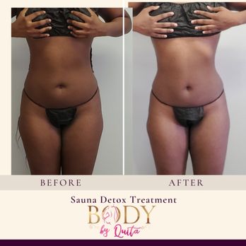 Body By Quita - Body Contouring Near Me - Temple Hills, Maryland Body By Quita - Body Contouring Near Me - Temple Hills, Maryland