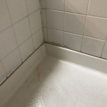 The Bathtub Medic - Before - Refinishing Services Near Me