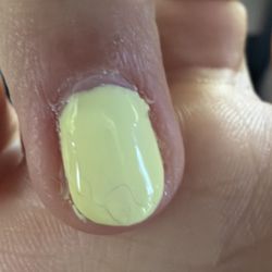 US Nail 3