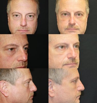 Baroody Plastic Surgery by null