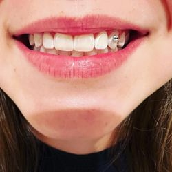 Q's Sunless Tanning - Teeth Gems, teeth whitening