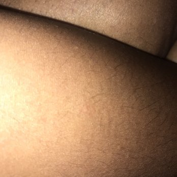 Spring Spa - Bed bug bites/ insect bites from sheets/ location. - Day Spas Near Me - Las Vegas, Nevada Spring Spa - Bed bug bites/ insect bites from sheets/ location. - Day Spas Near Me - Las Vegas, Nevada