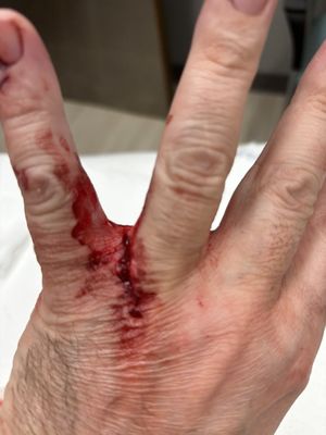 Hackensack Meridian Mountainside Medical Center by null