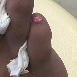 My toe nails aren't uneven. The unevenness your seeing is the paint on my nails, and then my skin, painted as one piece