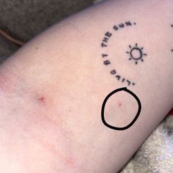 United Memorial Medical Center - Nurse poked me