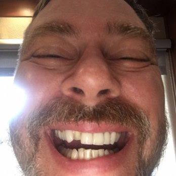 Robert Mondavi, DDS - This is "Doctor" Mondavi's handy work. Pay over $8,000 to have your smile look like this! Still want to go to this chop shop - Cosmetic Dentists Near Me Robert Mondavi, DDS - This is "Doctor" Mondavi's handy work. Pay over $8,000 to have your smile look like this! Still want to go to this chop shop - Cosmetic Dentists Near Me