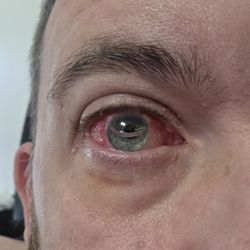 Visionworks - My eye they saved after a retinal detachment. Started having issues at 5 pm. They called the ER and helped me into surgery the next morning!