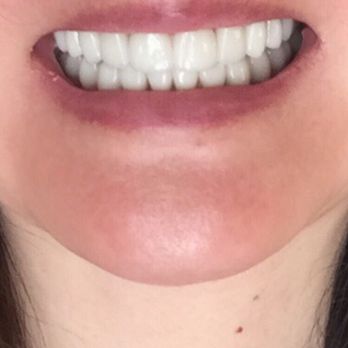 Yorktowne Dental Group - Smile - General Dentistry Near Me - Jenkintown, Pennsylvania Yorktowne Dental Group - Smile - General Dentistry Near Me - Jenkintown, Pennsylvania